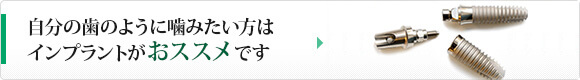 自分の歯のように噛みたい方はインプラントがオススメです