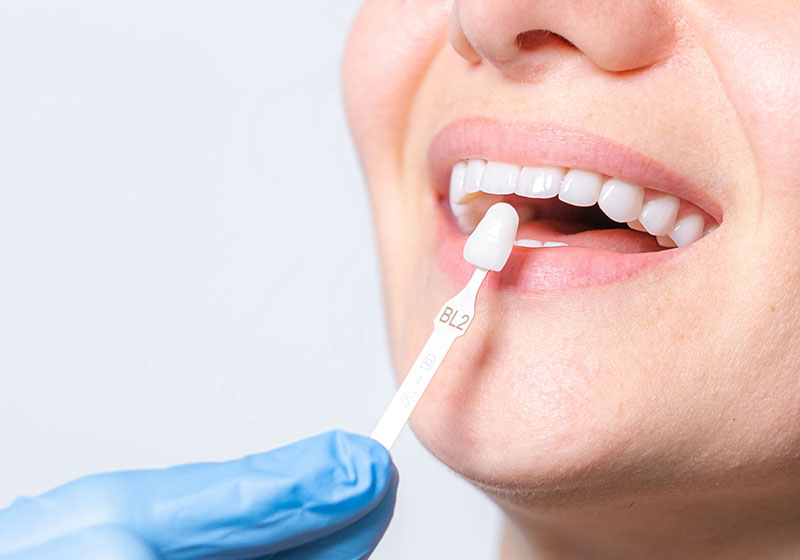 ②セラミック治療と共に、歯並びや歯ぐきも治療したい場合