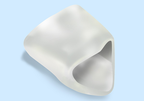 オールセラミック（クラウン・インレー）