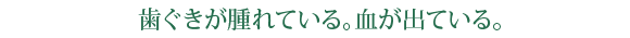 歯ぐきが腫れている。血が出ている。