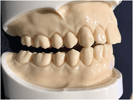 前歯と奥歯の重要な役割の画像02